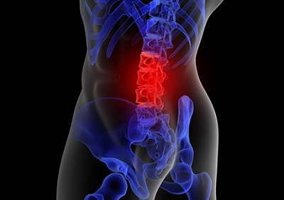 :: 월간암(癌) 예방과 투병의 올바른 길잡이 ::허리에 느껴지는 요통, 추나요법 적용 가능